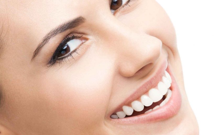 Dental Veneers Northampton