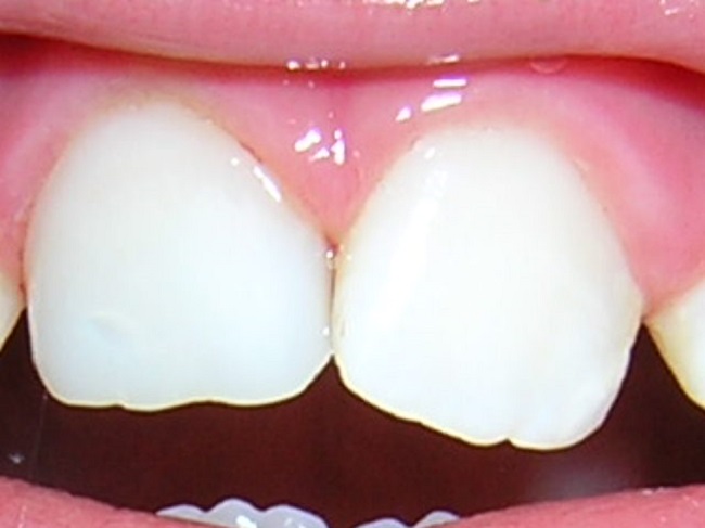 dental 008