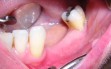 dental 010