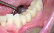 dental 011