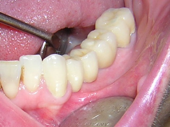 dental 011