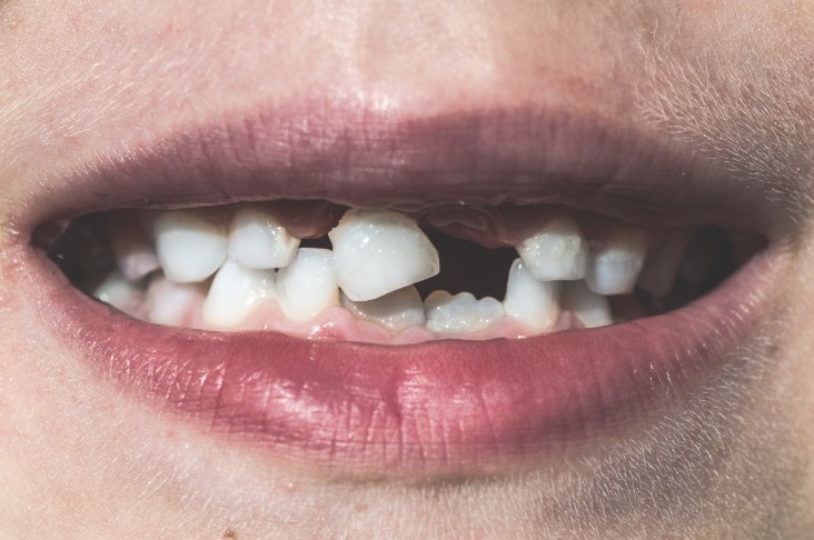 teeth health smile dental diabetes